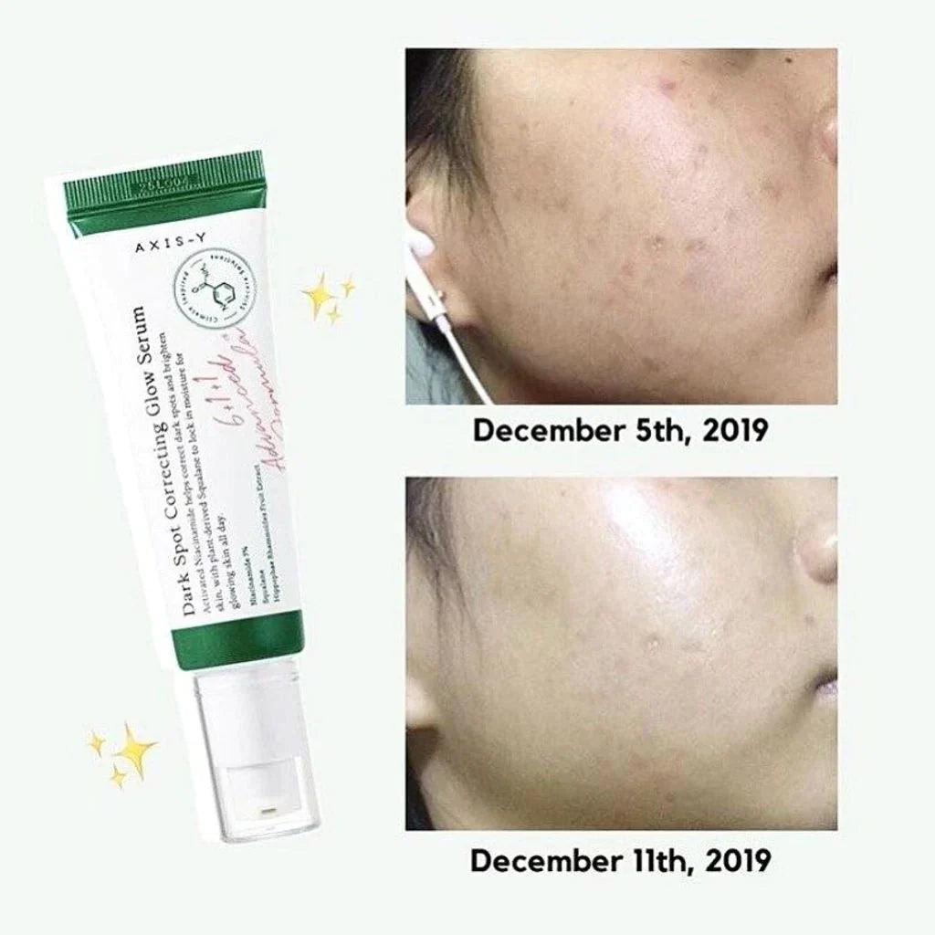 DARK SPOT CORRECTING GLOW SERUM